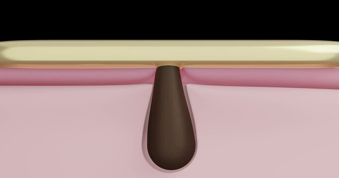 3d render animation of hair removal from the root, hair follicle, hair removal.  Application of the substance cream, wax, sugaring, sugar hair removal skin without redness