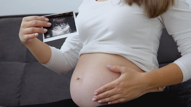 A pregnant woman strokes her tummy and shows a photo of the ultrasound diagnosis of the fetus