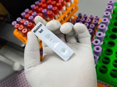 Rapid test positive cassette for Mimivirus test, DNA virus, agent of human respiratory disease,biggest virus, focus view
