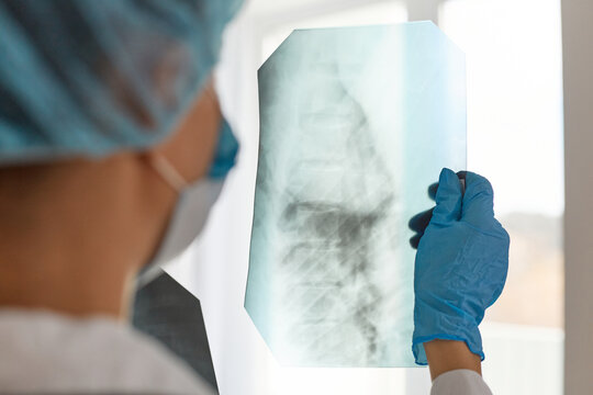 Closeup back side shot of woman doctor in medical cap and blue gloves, radilogist holding x-ray, holding radiology picture, thinking about illness and its trreatment, health care.