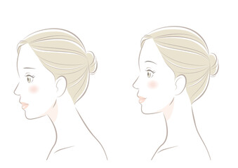 ストレートネックの女性