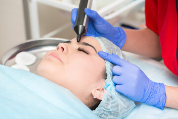 Cosmetic procedure for lifting the skin of the eyelids of Asian eyes. Non-surgical blepharoplasty...