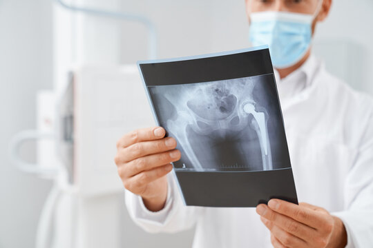Close up of doctor wearing mask holding scan with result after ultrasound diagnostic of pelvis. Radiologist learning hip bone on image after procedure of usg, doing diagnose. Concept of illness.