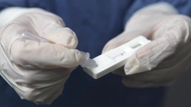 The doctor makes a rapid PCR test for the antigen of the covid-19 virus.	
