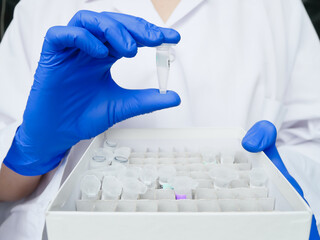 hands of scientist holds test tube with DNA patient sample. research technician with test sample...