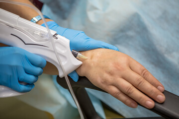 The doctor injects carbon dioxide using a needle machine into the skin of the patient's hand....