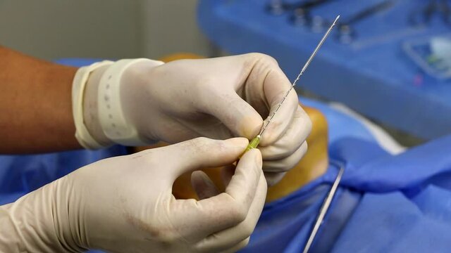 Rejuvenating facial thread lifting with a spiral thread.