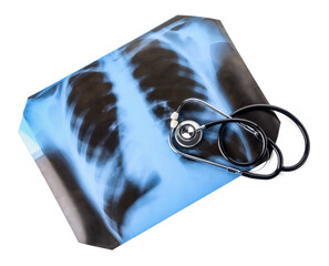 X-ray scan of lungs with stethoscope on white background