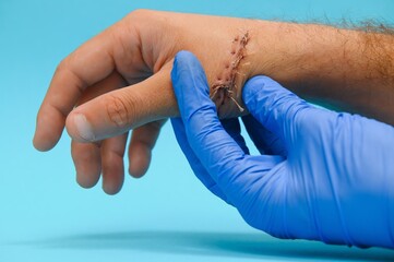 Examination and care of postoperative sutures on the patient's shoulder