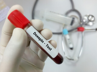 Scientist hold blood sample for Doxepin level test, antidepressants drug, to maintain therapeutic...