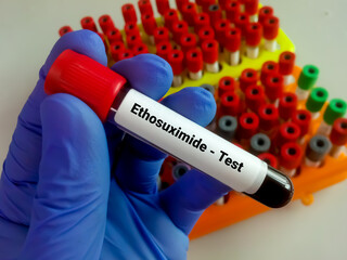 Blood sample for Ethosuximide level test, set therapeutic range and toxicity