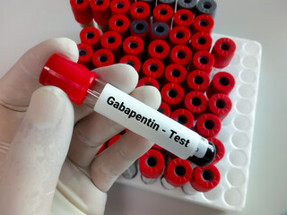 Blood sample for Gabapentin test.  Set therapeutic dose. Epilepsy, seizures.