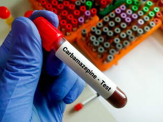 Obraz premium Blood sample for Carbamazepine test, to establish an appropriate dose and maintain a therapeutic level.