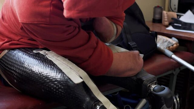 A man living with a disability with amputated arms and legs tries to put on a modern artificial bionic leg prosthesis and fix it with amputated two stump hands 