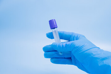 Vacuum tube for collection and blood samples with sodium citrate in blue gloves for laboratory on...