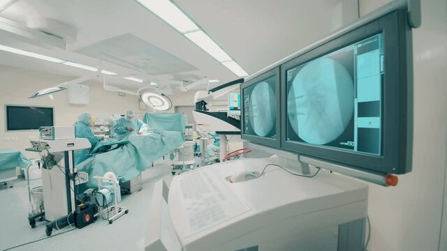 Operating room with a group of surgeons and scan images