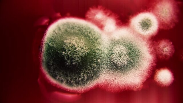 Fungal spores in the liquid. Viral bacterium in the blood.Fungal infection. Distribution and multiplication of fungi and bacteria. Virus attack.