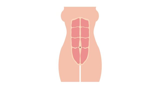 Formation of diastasis recti animation  from normal toned abdomen muscles, also known as abdominal separation, common among pregnant women 