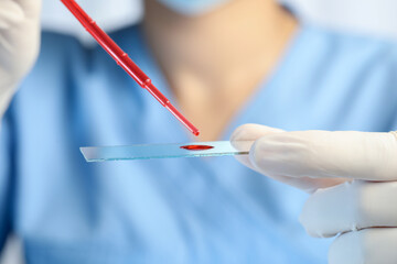 Scientist dripping sample of red liquid onto microscope slide, closeup