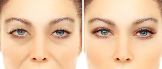 Aging. Mature woman-young woman.Face with skin problem.