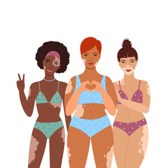 Three women with vitiligo standing together. - 468361609