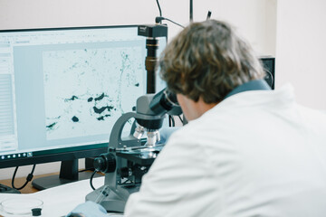 Scientist examines cannabis sativa mold through an electron microscope
