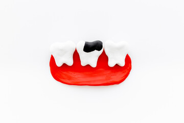 Dental health concept. Teeth models with caries or plaque