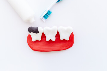 Teeth models with caries or plaque and toothbrush. Oral health concept