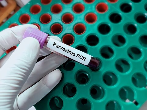 Biochemist or doctor holds blood sample for Parvovirus PCR test. Medical test tube in laboratory background.