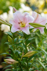Fototapeta premium Beautiful oriental hybrids in bloom. Growing bulbous oriental lilies in the garden. 