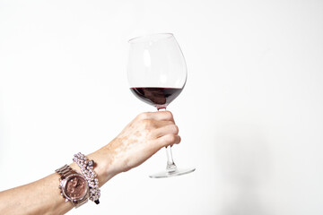 hand of a young woman with vitiligo toasting with a glass of red wine on white background.