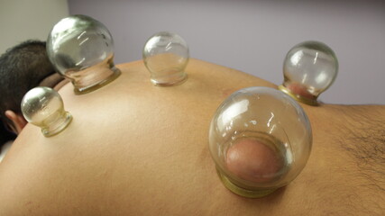 suction cups