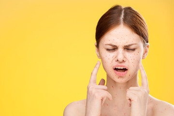 woman with bare shoulders red dots on her face health problems dermatology