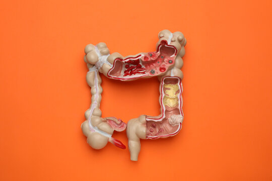 Anatomical model of large intestine on orange background, top view