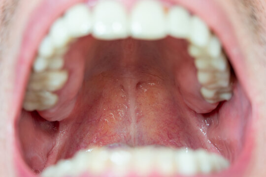 Back of the throat, roof of the mouth macro close up view of Caucasian male pharynx