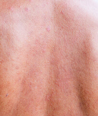 Naklejka premium An image of the rough skin of an older person.