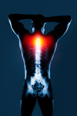 Naklejka premium Human spine in x-ray on blue background. The neck spine is highlighted by yellow red colour.