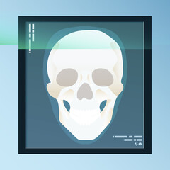 vector of human bones, skeleton and joints on x-ray sheet. medical equipment illustration