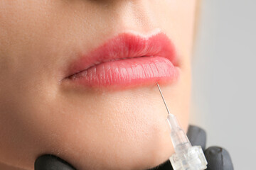 Lip augmentation in the beautician's office