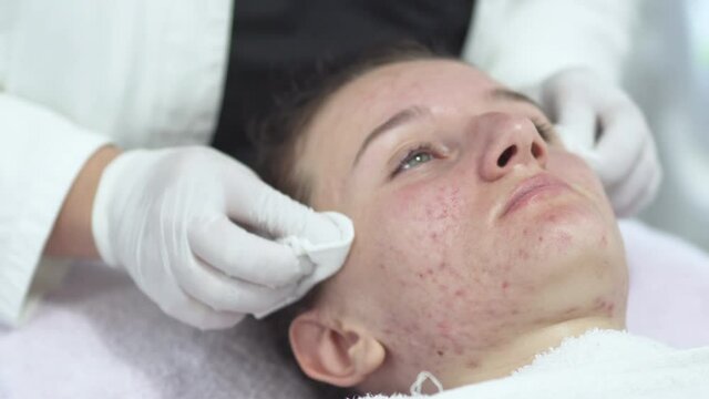 Acne treatment on a young woman's problematic skin by dermatologist or cosmetics salon