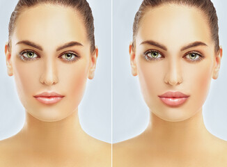 Beauty injections.Concept of rejuvenation.Lip augmentation