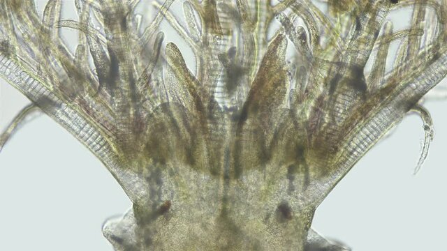 Polychaeta worm, family Sabellidae under a microscope. Filter, lives in a lime tube. Has Radiole tentacles with many cilia. Indian Ocean