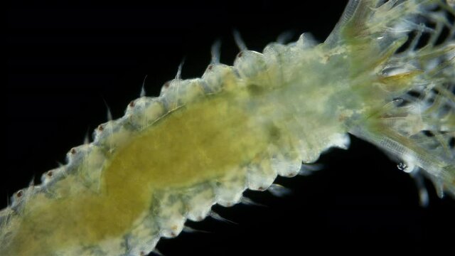 Polychaeta worm, family Sabellidae under a microscope. Filter, lives in a lime tube. Has Radiole tentacles with many cilia.