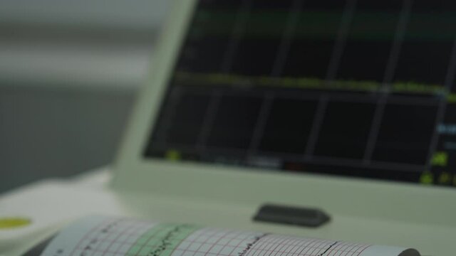 Electronic Cardiotocography Machine Monitoring Fetal Heart Contractions Of Uterus. Printing Cardiogram Report Coming Out Electrocardiogram In Labor Ward During Pregnancy. Medical Diagnostic Equipment