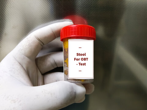 Stool OBT test at medical laboratory