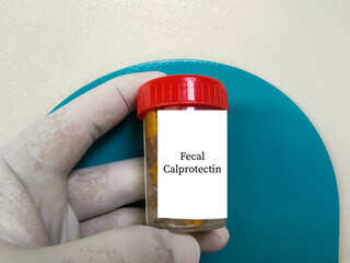 Doctor holding stool specimen jar for Faecal Calprotectin test. To diagnosis Inflammatory Bowel Disease