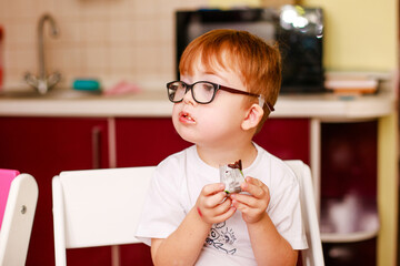 Redheaded boy with down syndrome holds a candy bar and eats it