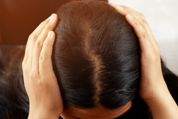 Naklejka premium A woman has a problem with hair loss.