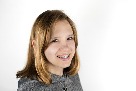 Portrait of a young beautiful girl on a white background with blond hair and braces on white teeth, a girl smiling. Dental concept