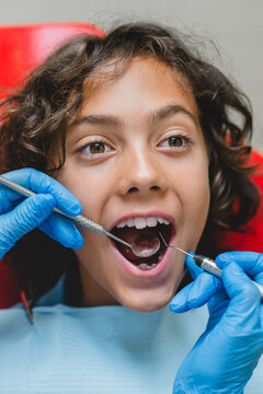 Vertical portrait of a boy`s face with opened mouth for dental checkup. Dentist orthodontist curing healing caries using dental equipment.